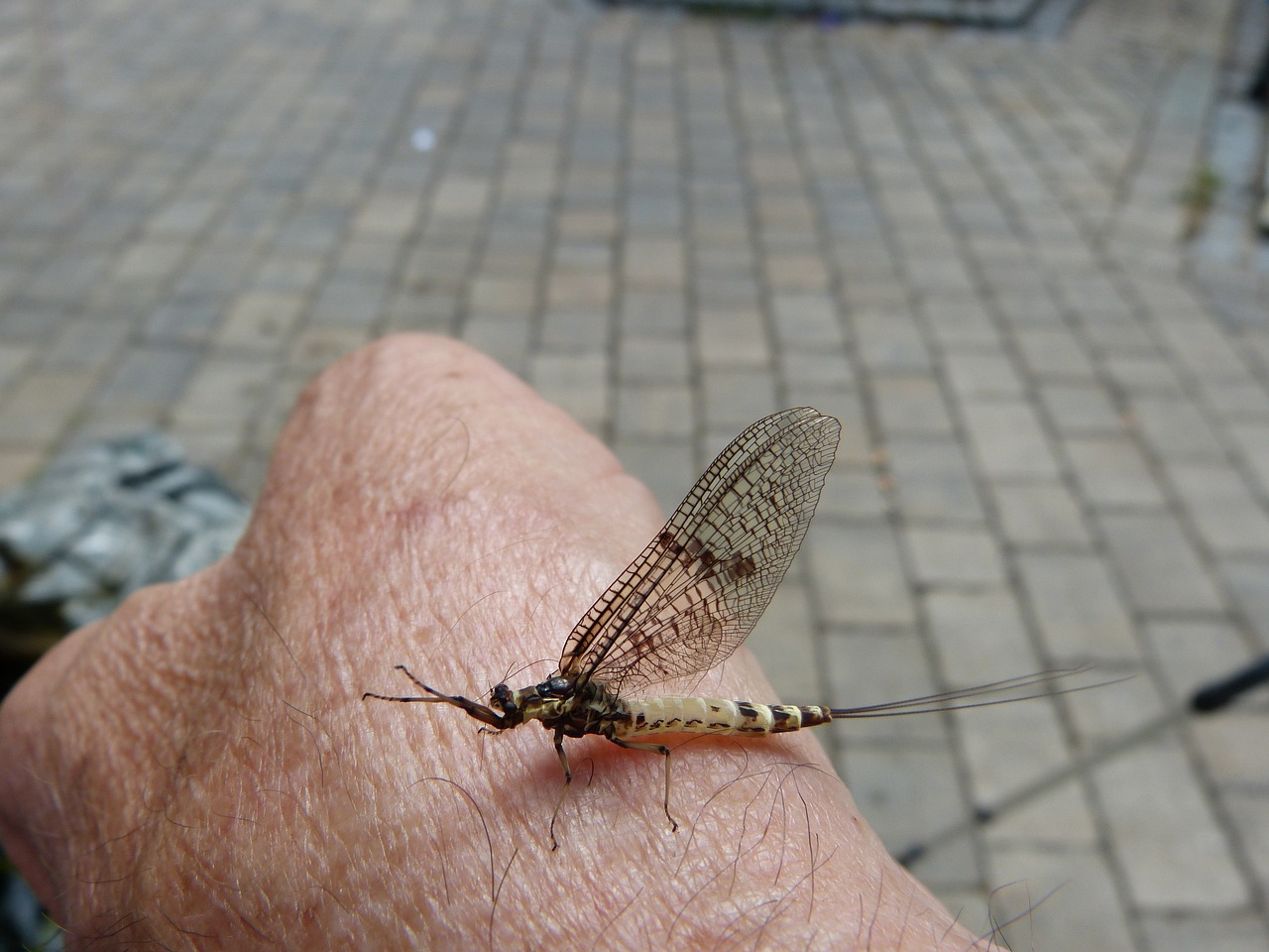 복부지흡